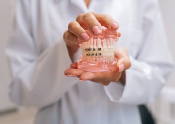 How Fast Can You Really See Results with Fastbraces®?